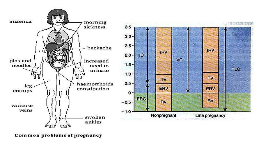 Common problem of pregnancy Maternity